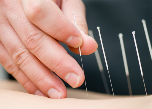 Integrative Acupuncture