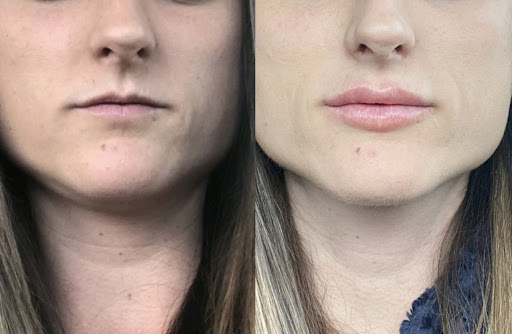 Cult Medical Aesthetics
