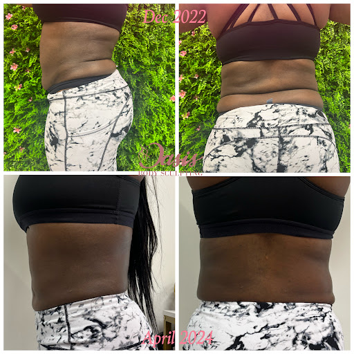 Oasis Body Sculpting