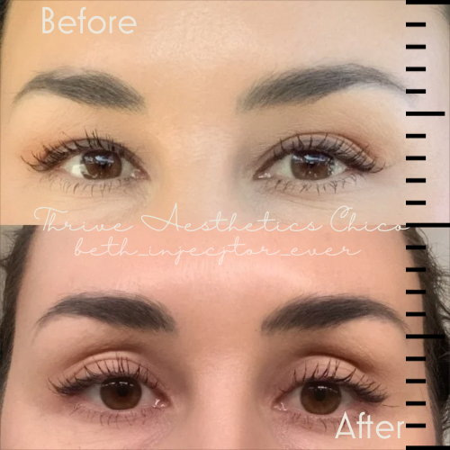 Thrive Aesthetics Chico