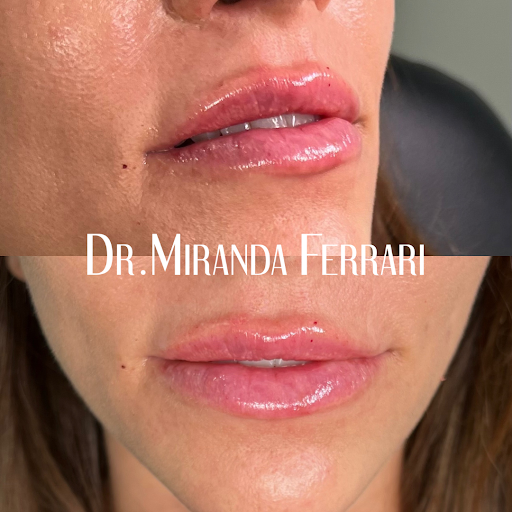 Ferrari Facial Aesthetics