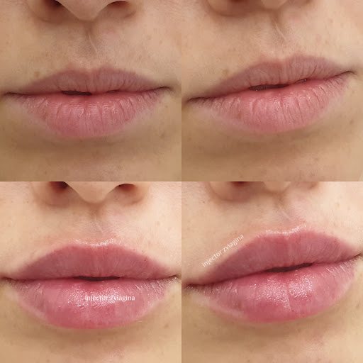 FACE LAB