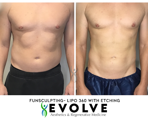 Evolve Aesthetics and Regenerative Medicine