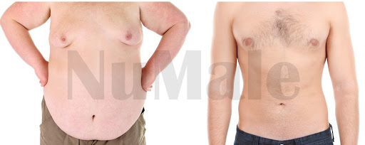 NuMale Medical Center