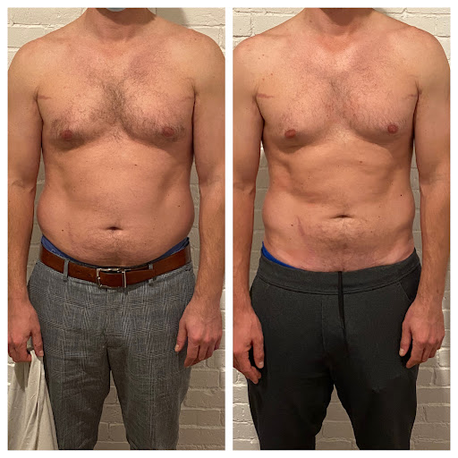 Vega Vitality MedSpa & Wellness - Back Bay Boston