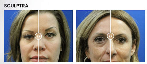 Advanced Regenerative Therapy